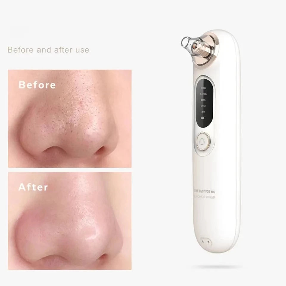 Blackhead Remover For Household Use, 5-Speed Wireless Electric Ultrasonic Pore Cleaning, Beauty And Blackhead Removal Instrument